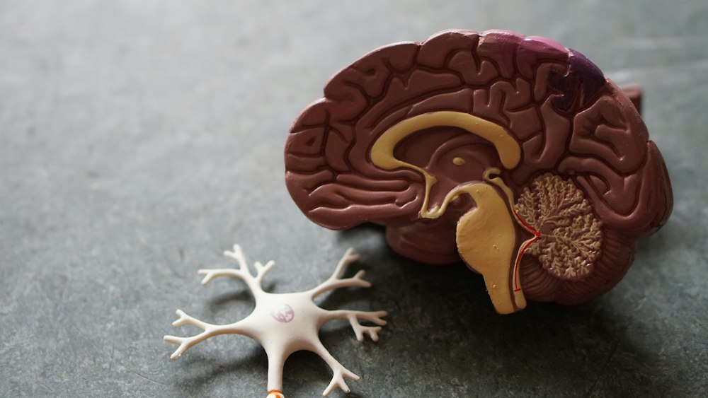 Clinician reviewing neurological imaging